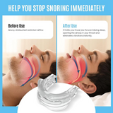 Sleep Mouth Guard